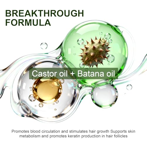 Haarwachstum Serum Beschleunigen, Hair Growth Serum Spray, Haarausfall Verhindern, MäNner / Frauen, mit RosmarinöL Batana öL FüR Haar, Vegane Haarprodukte, Alle Haartypen