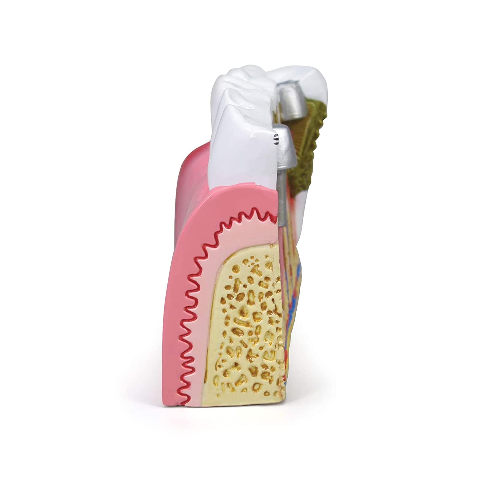 Dentalmodell, Anatomie des menschlichen Körpers, Nachbildung von Zähnen mit/häufigen Pathologien, für die Zahnarztpraxis, Lehrmittel, Anatomicals