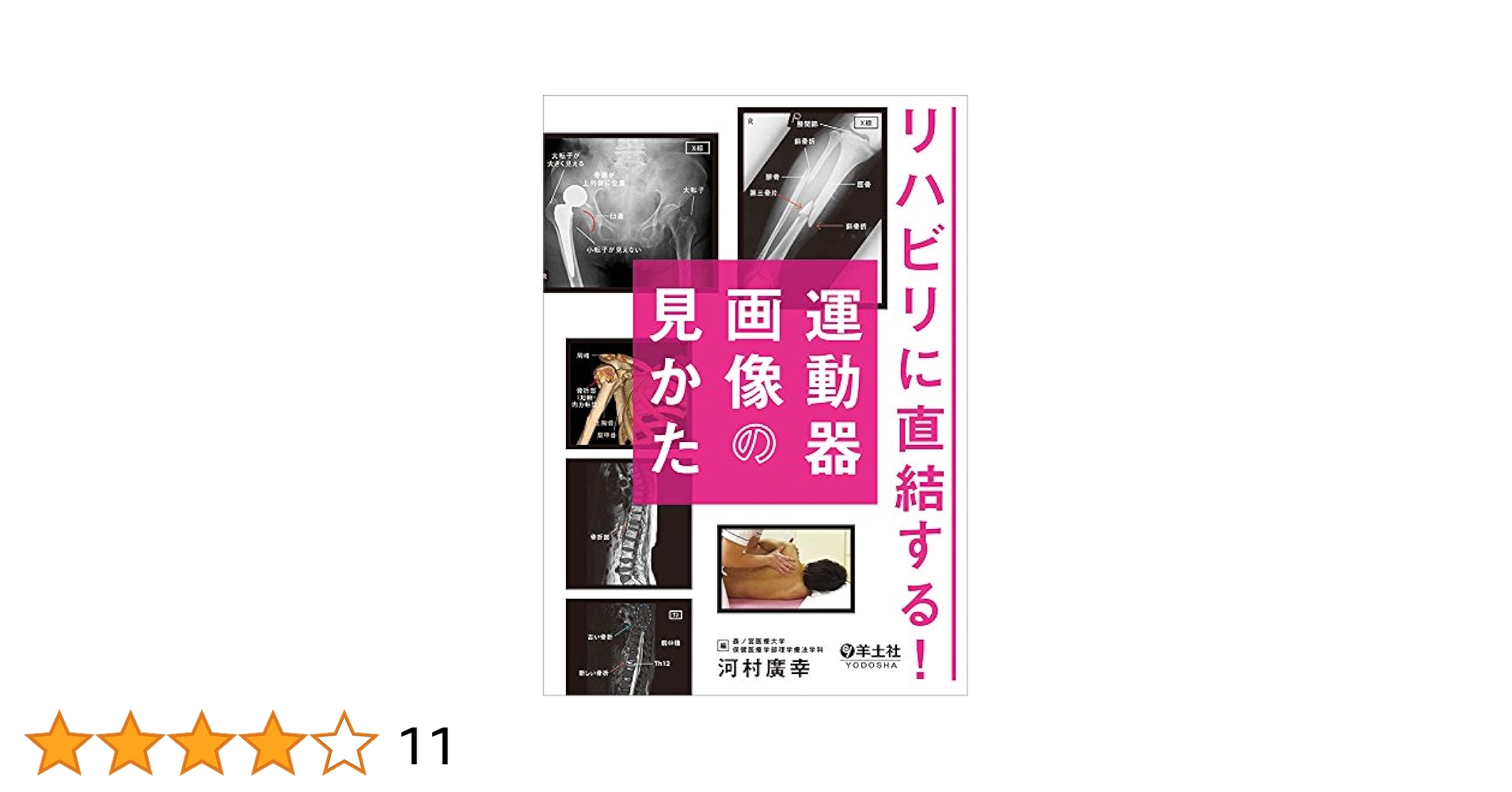 運動器X線画像の見方　ジャパンライム メジカルビュー社｜理学療法士｜リハで読むべき運動器画像