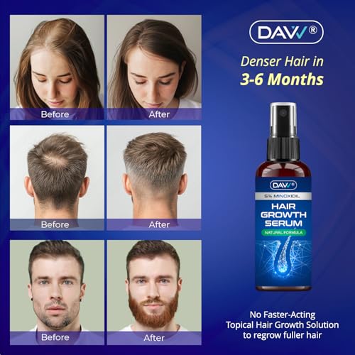 Image of 5% Minoxidil for Women and Men: Minoxidil Spray - Minoxidil for Men Hair - Hair Growth Products - Hair Growth Serum with Rosemary - Extra Strength Hair Loss Solution - Faster Stronger Thicker - 60ml