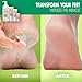 Miracle Foot Repair Cream (32 oz) Repairs Dry Cracked Heels and Feet, 60% Pure UltraAloe Moisturizes, Softens, and Repairs