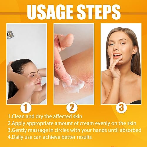 Psoriasis Treatment Cream, Crema Corpo per Pelle