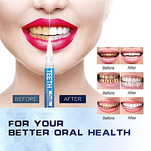 Pankooteeth 0803-BMYB02 Teeth Whitening Pen, Use Twice A Day Up To 1-6 Shade Whiter In 1-2 Weeks thumb #1