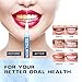 Teeth Whitening Pen, Use Twice a Day Up to 1-6 Shade Whiter in 1-2 Weeks, 4 No Sensitivity Pens, 70+ Whitening Treatments, Effective, Pain Free and Enamel Safe, Easy to Use at Home Travel, Flavourless