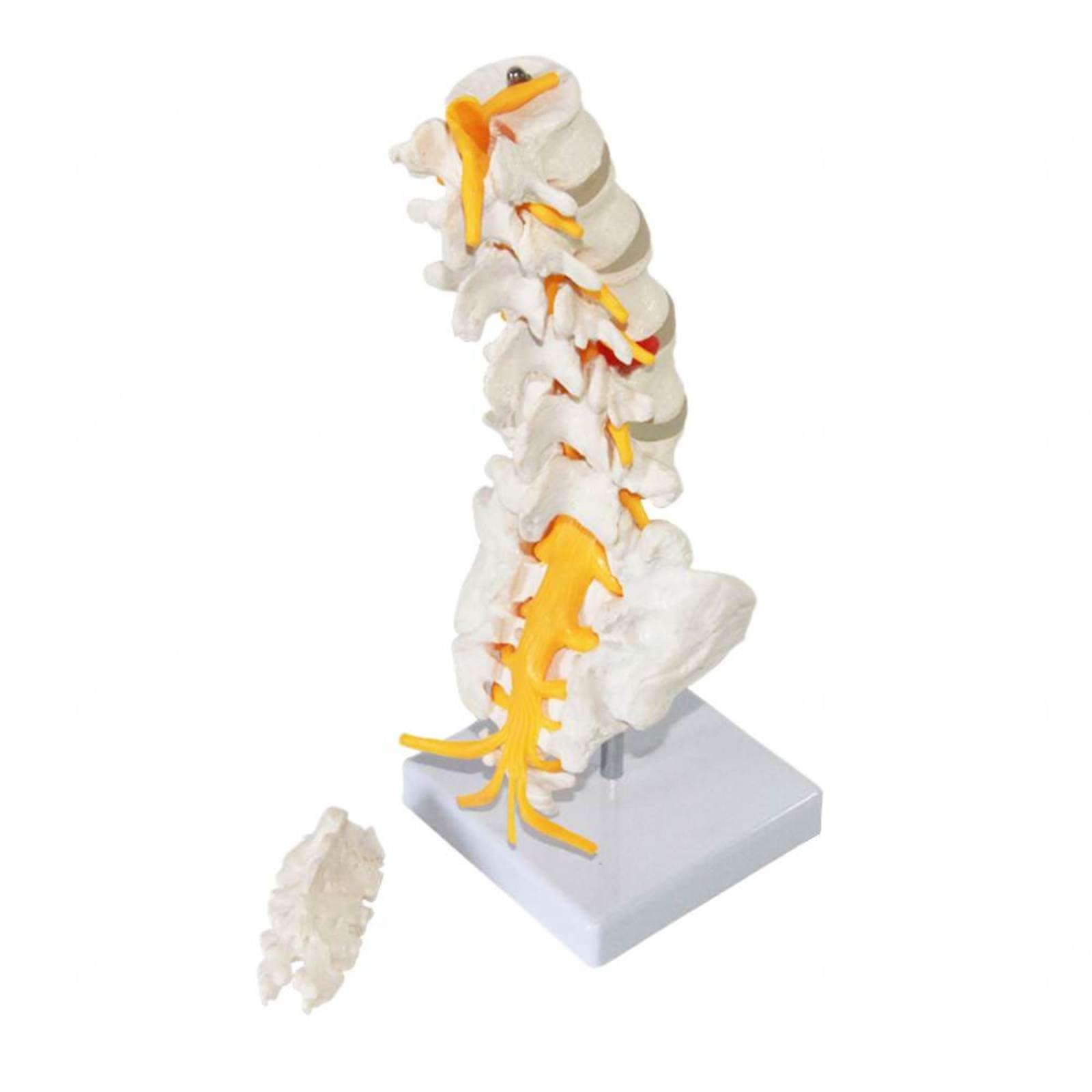Amazon.co.jp: 腰椎モデル 脊椎モデル 背側椎間板ヘルニア付きの可動型
