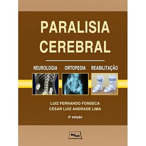Paralisia cerebral - Neurologia, ortopedia e reabilitação: Neurologia, Ortopedia, Reabilitação