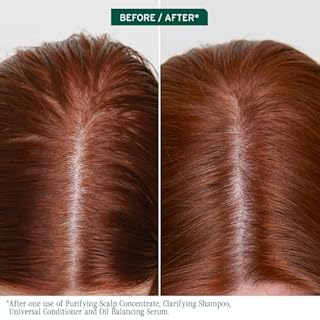 Biolage Oil Balancing Serum, For Oily Scalp, Absorbs & Reduces Excess Oil, Scalp Sync Leave-In Serum, Vegan, Cruelty Free, Paraben & Silicone-Free, 50 ML