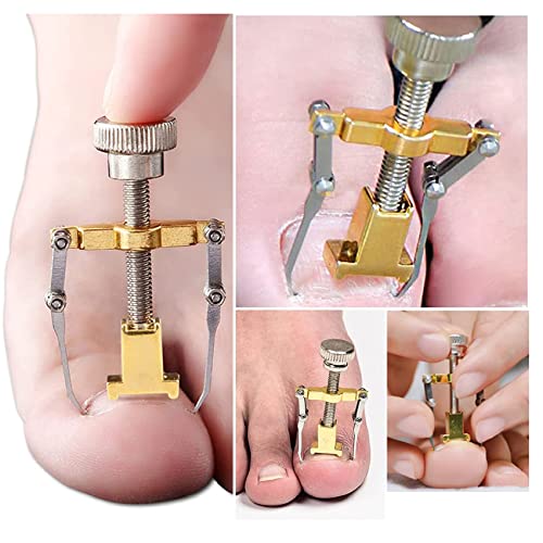 77 Pieces Ingrown Toenail Tools Set,Ingrown Toenail Correction Patch Stickers,Ingrown Toenail Treatment Lifter,Toe Nail Patch Correction Buckle File Cuticle Pusher #TOP3