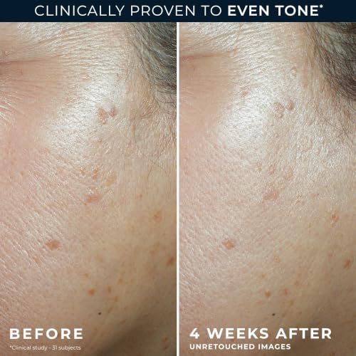 RoC Niacinamide Daily Face Moisturizer SPF 30, 5 in 1 Even Tone + Lift - image 5