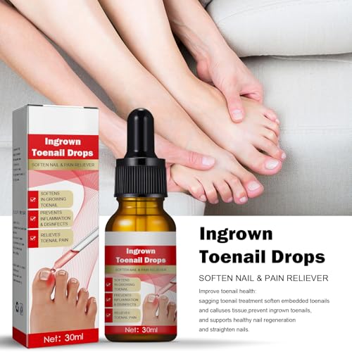 Eingewachsene Zehennägel Behandlung - 30ml Eingewachsene Zehennägel - Nagelhautpflege Öle für eingewachsene Zehennägel