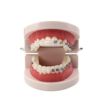 Dental Standard Teeth Model Typodont Metal/Ceramic Brackets for Demonstration Metal and Ceramic