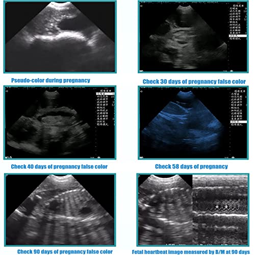 Goyojo 789513441424 Ultrasound Machine For Pregnancy thumb #3