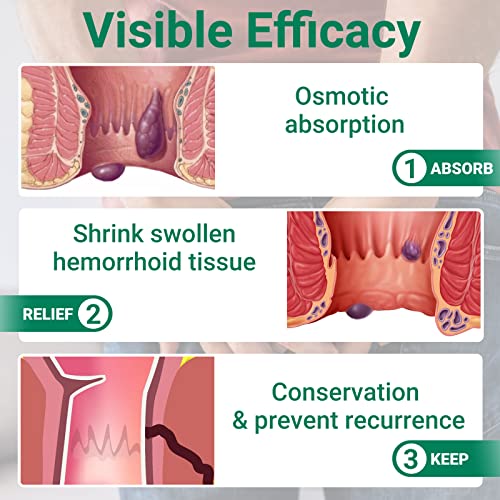 LMNOOP Hämorrhoiden- und Fissurensalbe, Behandlung mit maximaler Stärke und schnelle Linderung bei Schmerzen, Brennen, Juckreiz, Schwellungen, Blutungen, innere und äußere Hämorrhoidencreme (2-Pack)