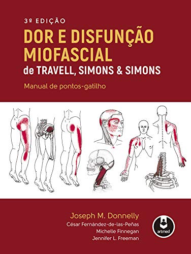 Dor e Disfunção Miofascial de Travell, Simons & Simons: Manual de Pontos-gatilho