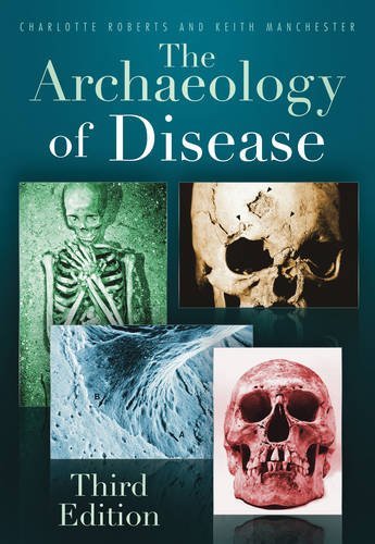 The Archaeology of Disease by Charlotte Roberts (2010-07-01)