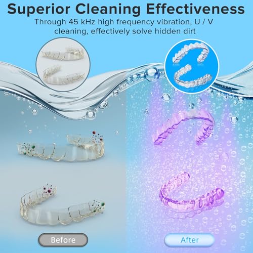 Image of Ultrasonic Retainer Cleaner, 180ML /45kHz Portable Ultrasonic Jewelry Cleaner, Quiet Operation Ultrasonic Cleaner Machine for Dentures,Aligners,Mouth Guards,Night Guards (Gray)