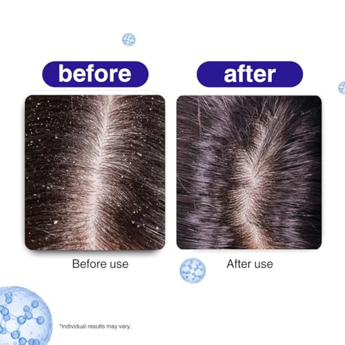 BONJI Scalp Soothing Hair Oil - 50ml - Image 8