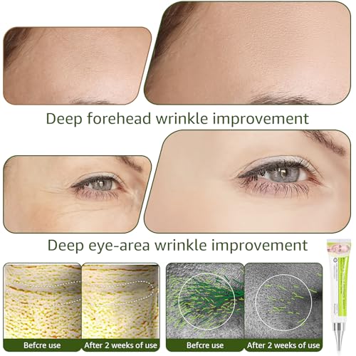 Generic 3 Pack Botoxmix & Vita-A Retinol Shot Wrinkle-Lift Tightening for Wrinkles, Fine Lines and Pore Refining, Retinol Shot for All Skin Types