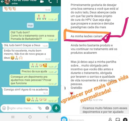 Kit Barbatimão de Alagoas – Solução para Verrugas e Cuidados com Áreas Delicadas (KIT ALFA)