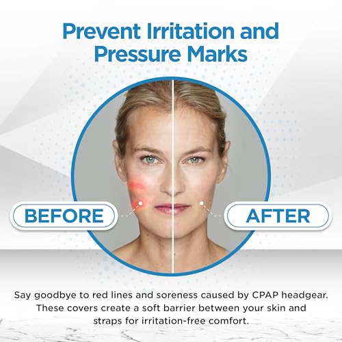 Image of resplabs CPAP Strap Covers | Compatible with Most Full Face and Nasal CPAP Mask Headgear | Universal | 4 Pack