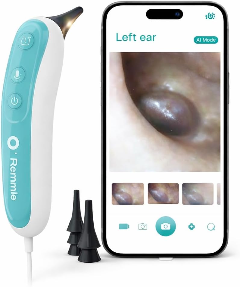 Remmie 4 AI-Powered Digital Otoscope with Light for Home Use - Ear Infection Checker for Kids & Adults - Nose Scope Video Camera with Telemedicine-Enabled App - FDA-Registered