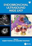 Endobronchial Ultrasound Made Easy (English Edition)
