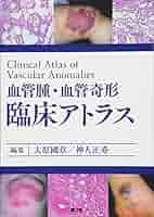 カラ-アトラス血管疾患 ｉｔｓ　ｃｌｉｎｉｃａｌ　ａｎｄ　ｐａｔｈｏｌｏｇ/ライフサイエンス出版/北村惣一郎（大型本） カラ-アトラス血管疾患 its clinical and