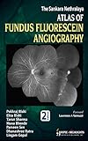 The Sankara Nethralaya: Atlas of Fundus Fluorescein Angiography