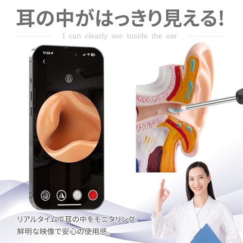 耳かき カメラ付き 耳掃除 光る耳かき カメラ付き耳かき スマート みみかき カメラ 耳かき子育て 耳 カメラ イヤースコープ 耳掻き 交換用パーツ付き 子ども 耳の中が見える (ブラック)