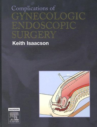 Buy Complications of Gynecologic Endoscopic Surgery — BookShops.in