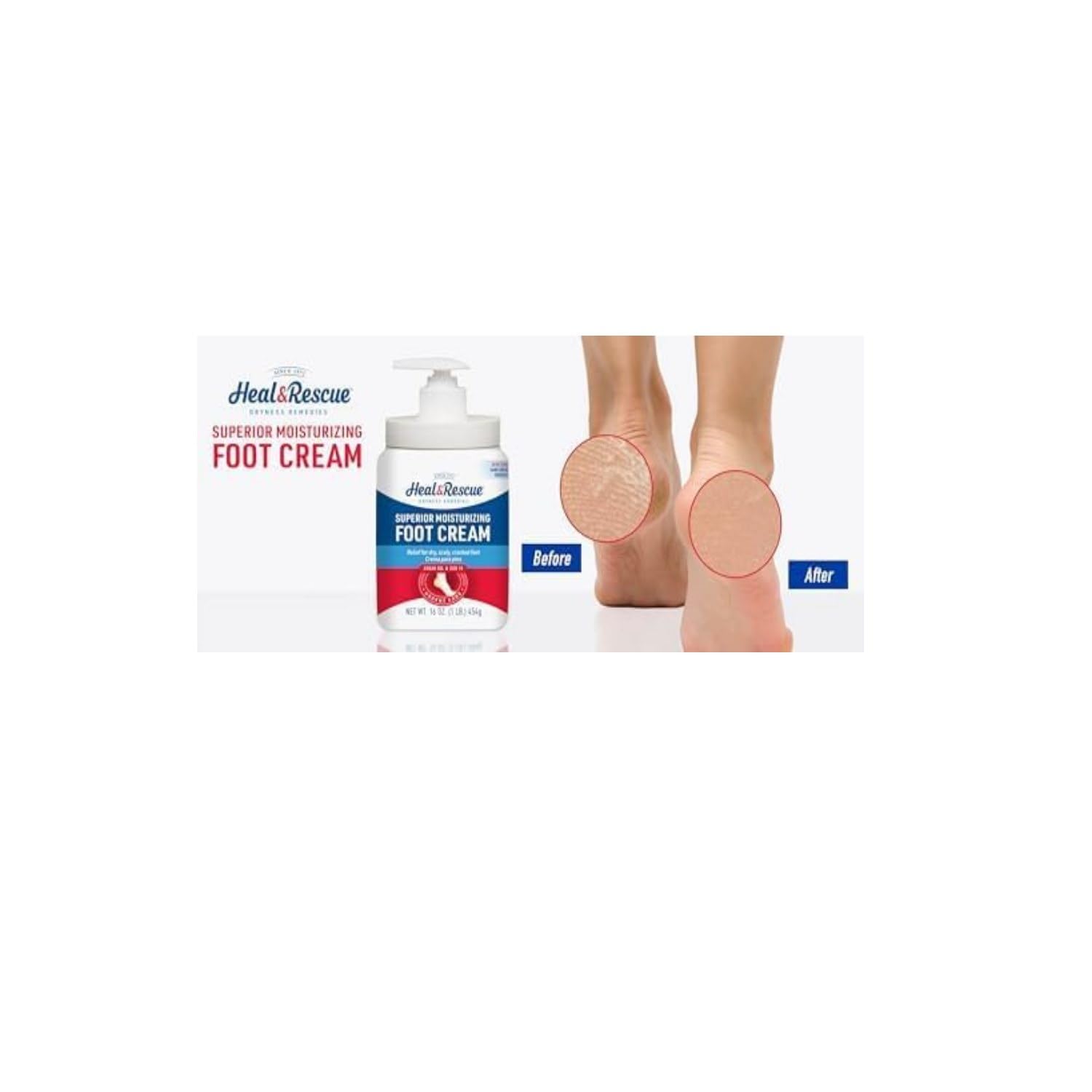 ProFoot Heel Rescue Superior Moisturizing Foot Cream 16 oz (Pack of 5)
