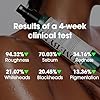 SOME BY MI AHA BHA PHA 30 Days Miracle Body Toner Mist – 4.73oz, 140ml – Body Acne Spray for Back & Chest, Exfoliating Body Mist with Salicylic Acid, Tea Tree, Niacinamide – Korean Skincare #3