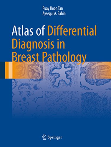 Atlas of Differential Diagnosis in Breast Pathology (Atlas of Anatomic Pathology) (English Edition)