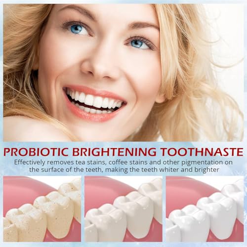 Image of SP-6 Probiotics Whitening Toothpaste - Probiotics for Teeth Whitening and Gum Health - Enamel-Safe, Fluoride-Free, Double Mint Flavor,Fresh Breath (3PCS)