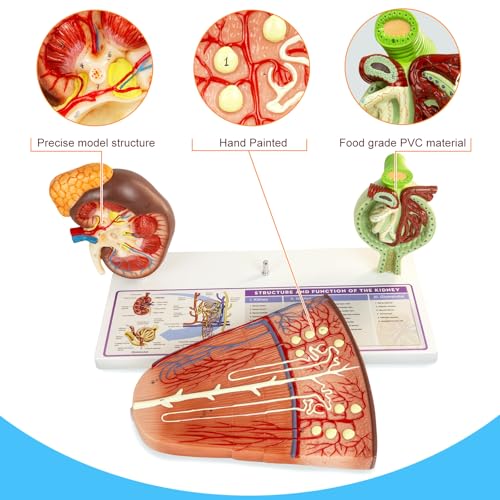 Image of Kidney Model, Human Kidney Nephron and Glomerulus Model, Kidney Anatomy Model for Medical Education Assisted Dissection Suitable for Anatomy Students, Urologists, Patient Consultation