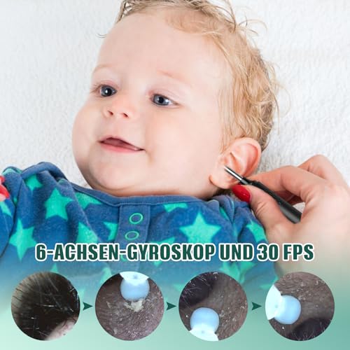 Ohrenschmalz Entferner mit Kamera, LMECHN 1080P HD-Otoskop, Ohrenreiniger mit WLAN, IP67 Wasserdicht, 6 LEDs, für iPhone, iPad & Android-Telefon (Schwarz)