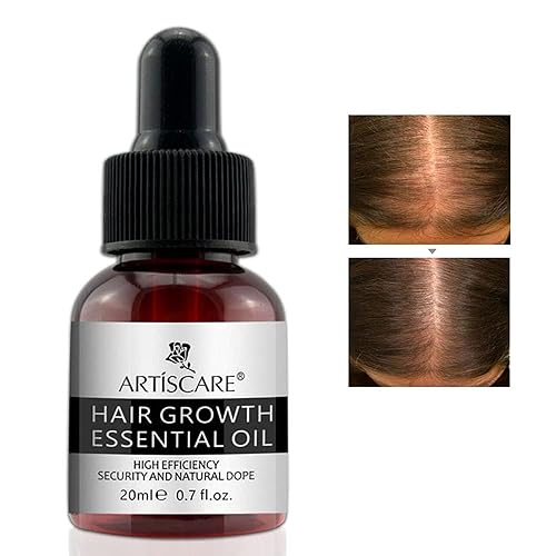Aceite esencial para el crecimiento del cabello para mujeres y hombres, mejora el cuidado del cabello dañado, suero para el cuero cabelludo,