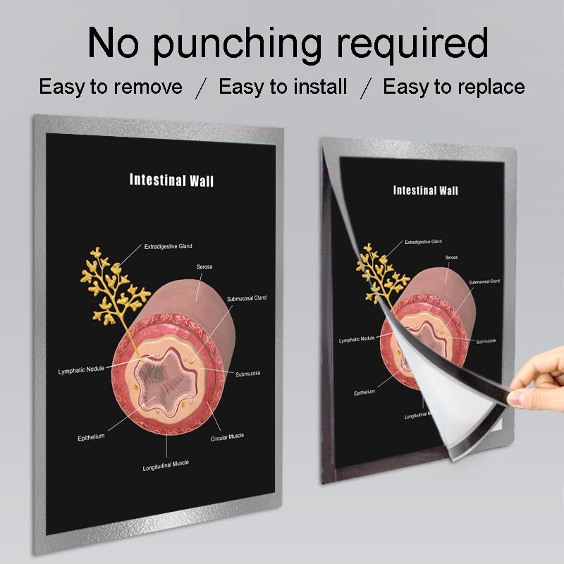 Image of Taanfu Body Educational Learning Anatomy Posters ，Intestine Wall Art Intestinal Villi Anatomy Art Poster Digestive System Organs Illustration Small Intestine Physiology Anatomy Wall Art Villi