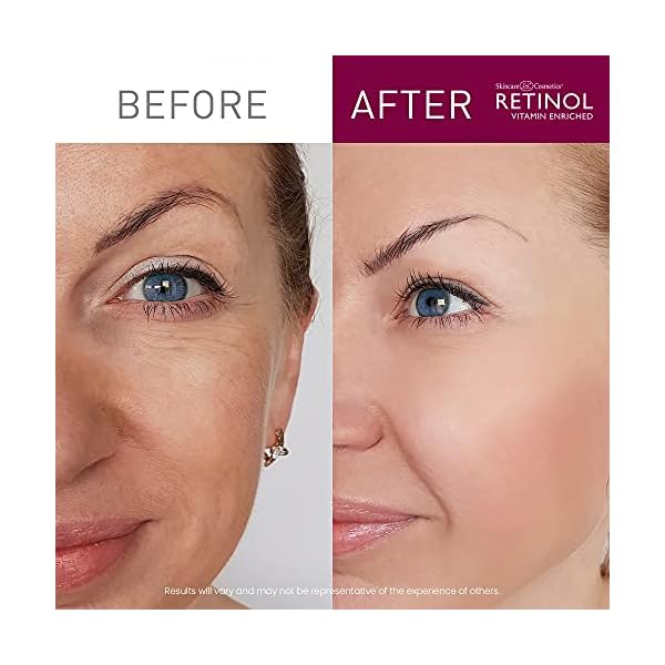 Retinol-Anti-Aging-Sheet-Mask--Hydrating-Vitamin-Enriched-15-Minute-Treatment-With-Collagen-Firms-Face--Exfoliates-for-Improvement-In-Tone-Minimizes-Fine-Lines-Wrinkles-For-Noticeable-Difference Retinol Anti-Aging Sheet Mask â Hydrating Vitamin-Enriched 15 Minute Treatment With Collagen Firms Face â Exfoliates for Improvement In Tone & Minimizes Fine Lines & Wrinkles For Noticeable Difference