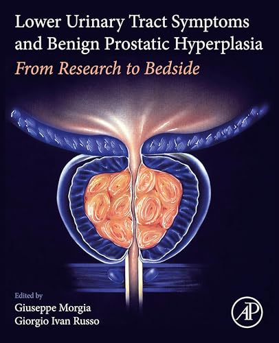 Lower Urinary Tract Symptoms and Benign Prostatic Hyperplasia: From Research to Bedside (English Edition)