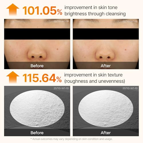 Image of Dr. Melaxin Peel Shot Kojic Acid Turmeric Serum - Exfoliating Dark Spot Corrector with AHA /BHA & Niacinamide, Brightening & Even Tone Facial Serum (80ml / 2.70 fl oz)