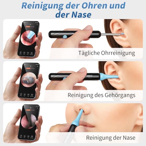 Qimic Ohrenschmalz Entferner Otoskop, WiFi Ohrreiniger, IP67 Wasserdicht und 360°-Weitwinkel Otoskop Kamera mit 6 LEDs für Erwachsene, Kinder und Haustier, Schwarz
