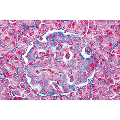 3B Scientific GmbH W13417 Endocrine System Micro. Slides/Set of 5, Grade: 1 to 2