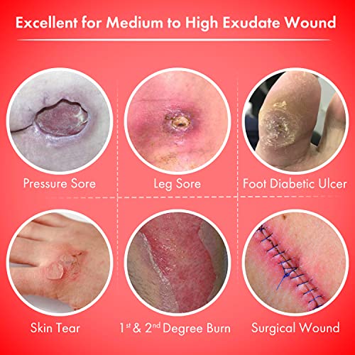Foam Gentle Border Dressing Silicone Square Adhesive Border For Bed Sore Leg Ulcer Foot Diabetic Painless Removal High Absorbency Waterproof Wound Care 3 X 3" Pack Of 10 By Medical Is Us #TOP1