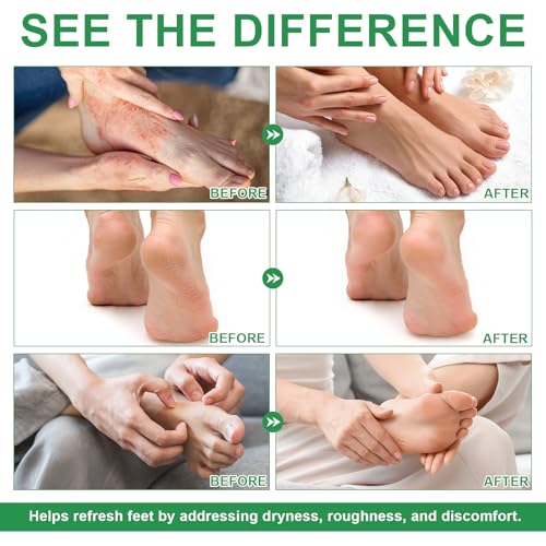 Image of Foot Tea Tree Oil Spray - Odor Control & Itch Relief with Tea Tree Oil | 120ml (4oz) | Natural Foot Deodorizer for Fresh, Clean Feet.