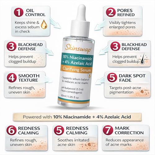 Image of Active 14% Niacinamide Serum with Azelaic Acid | Clarifying Face Serum for Brightening & Oil Control | Helps Reduce Acne, Blemishes & Acne Marks | Smooth, Clear-Looking Skin | For Women & Men | 30 ml