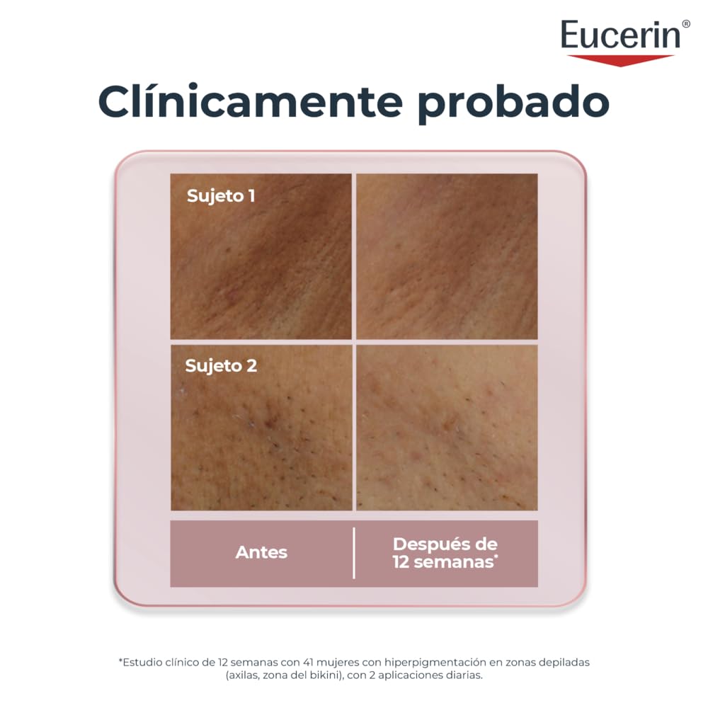 Eucerin Siero corpo anti-pigmento per aree sensibili (75 ml), siero nutriente anti-pigmento per il trattamento dell'iperpigmentazione con tiamidolo