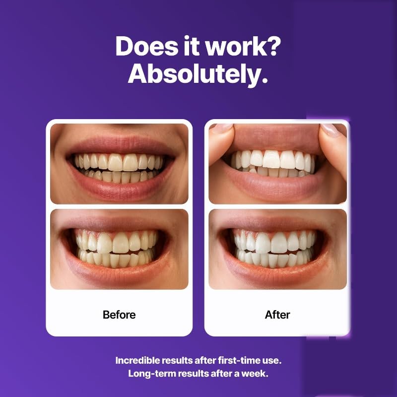 DrDent PURPLE WHITENING STRIPS(1 pièce - 42 pièces)