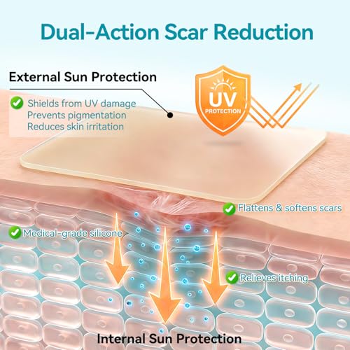 Image of Dimora UPF50+ Silicone Scar Sheets with UV Protection Reusable Sheets to Soften, Flatten Fade Scars, Reduce Redness for Surgical, C-Section, Burn, Keloid, and Hypertrophic Scars (1.6 inchx78.7 inch Roll)