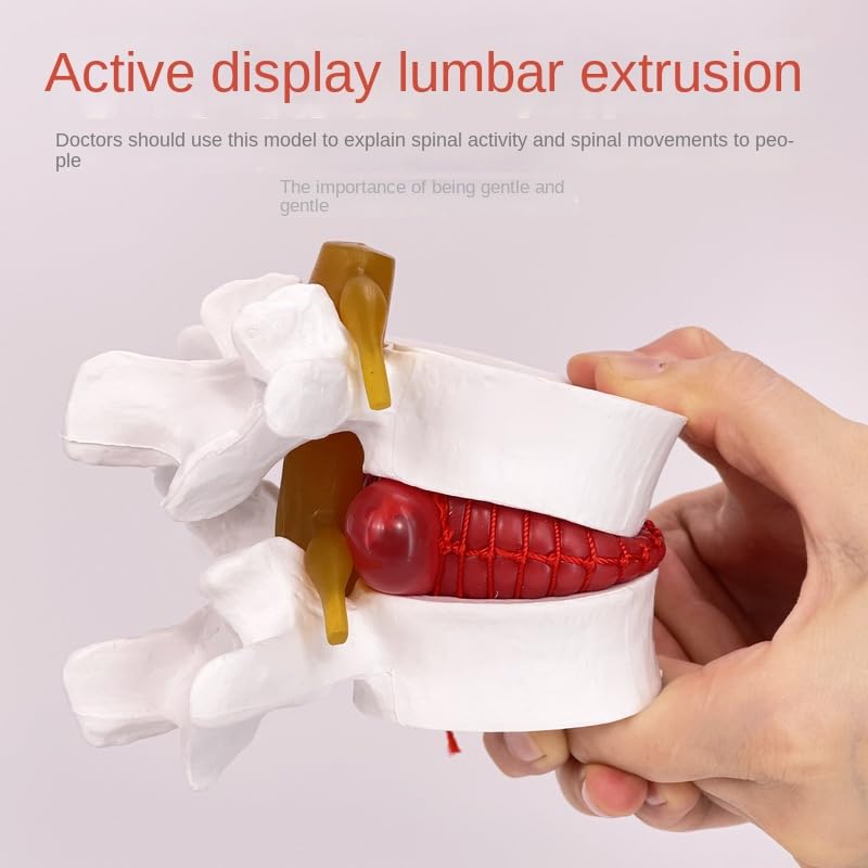 Lumbale Disc Model, Lumbale Wervelkolom Model Demonstratie Model Plastic Medisch Onderwijsmodel Voor Orthopedie Chirurgie Voor Lesgeven Demonstratie
